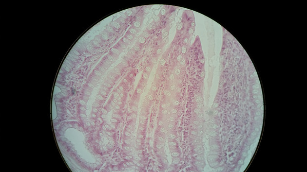 Colon Slides - Colon 002 400X